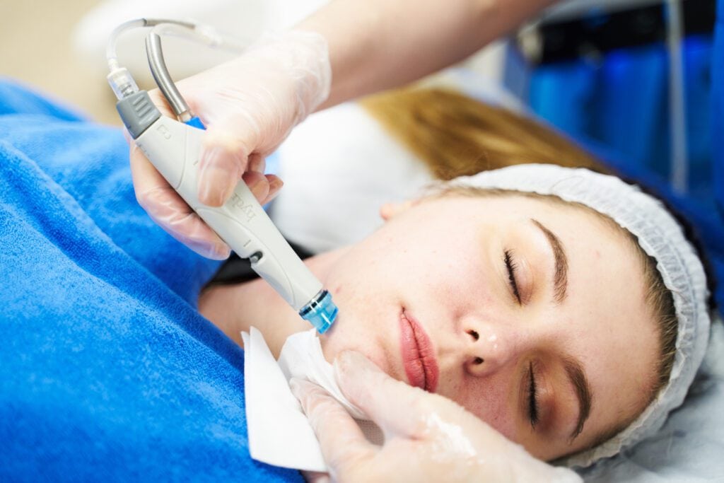 Hydrafacial treatment