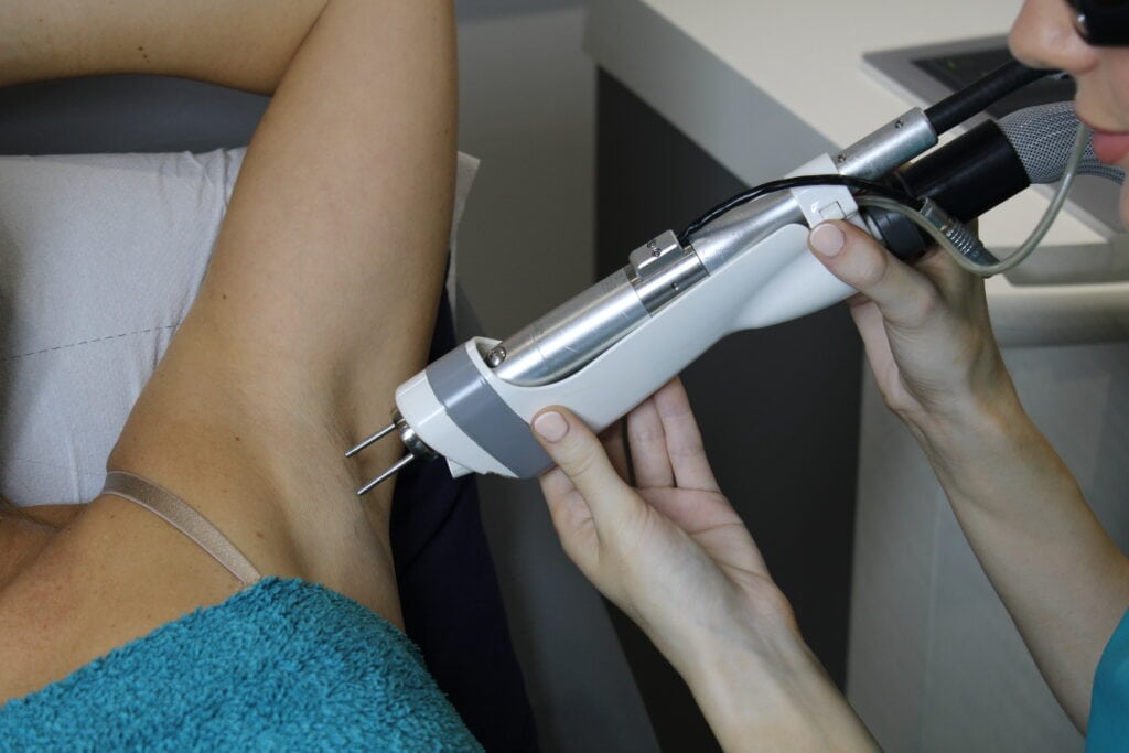 A clinician performing laser hair removal on a patient's underarm.