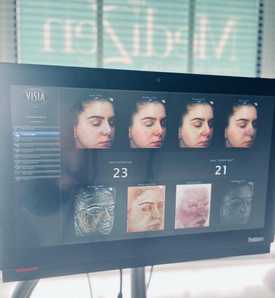 Visia screen