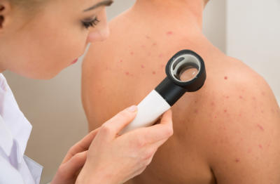 Dermatology