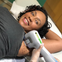 miraDry sweat gland treatment