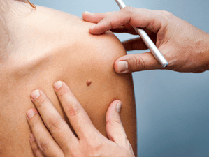 dermatology