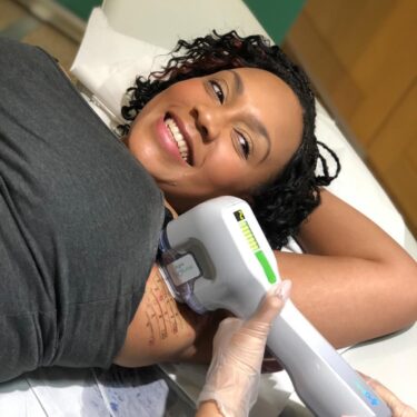 Patient receiving miraDry treatment for excessive sweating at MediZen clinic.