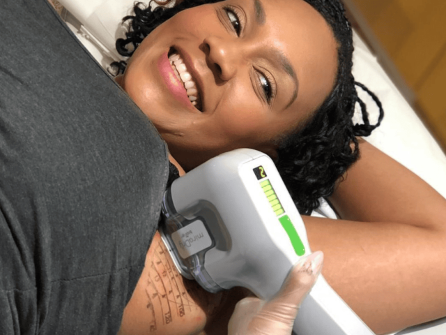 Woman receiving laser treatment for excessive sweating at MediZen clinic.