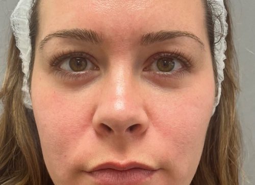 Close-up of a woman's face with clear skin and natural expression.