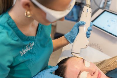 aviclear acne laser
